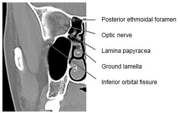 posterior ethmoidal foramen