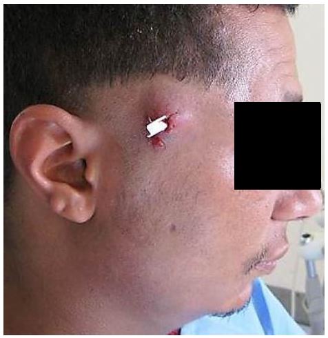 Html View Of The File Surgical Drainage Of Neck Abscesses