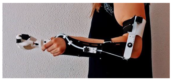 Figure 4: The bypass socket of the ADL arm